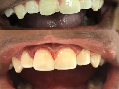 Main Dentistry | Cosmetic & General Dental Clinic - The Colony