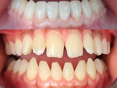 Main Street Implant & Family Dentistry, El Dorado, KS Dentist