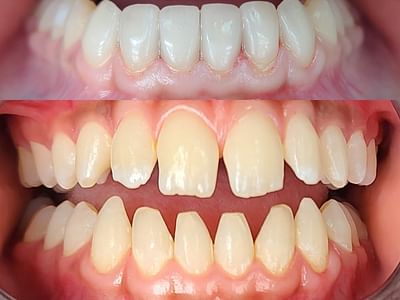 Main Street Implant & Family Dentistry, El Dorado, KS Dentist