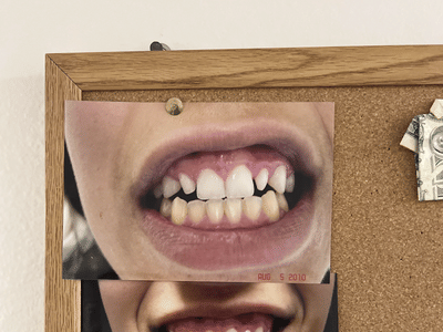 Manteca Smiles | Family Dentist in Manteca