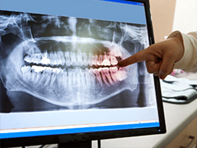 Mark Tickle DMD Family & Implant Dentistry