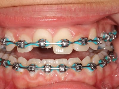 Marquis Family Dentistry