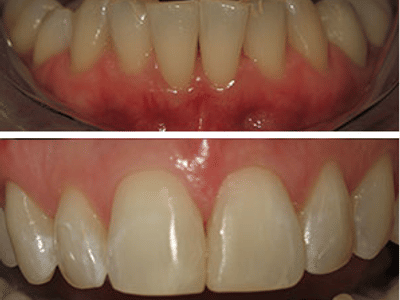 Martin E Poarch, DDS Cosmetic & Family Dentistry