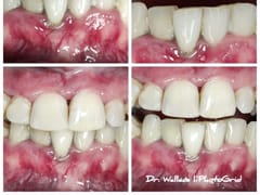 Maumelle Family Dentistry