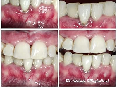 Maumelle Family Dentistry