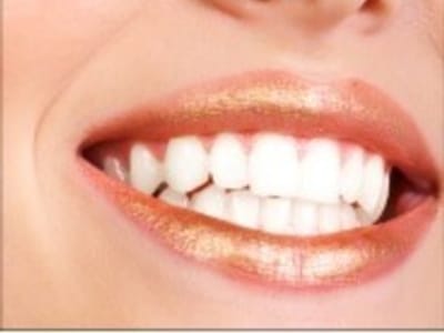 McCosh Dental - Coconut Creek, Margate Dentist
