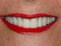 Meadowlark Dental Associates - Kearney, NE