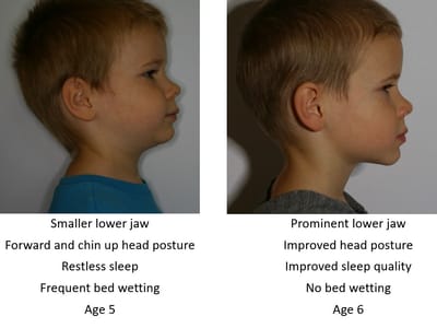 Medford Dentist - Dr. Nathan Tanner DMD