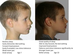 Medford Dentist - Dr. Nathan Tanner DMD