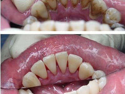 Meramec Family Dentistry