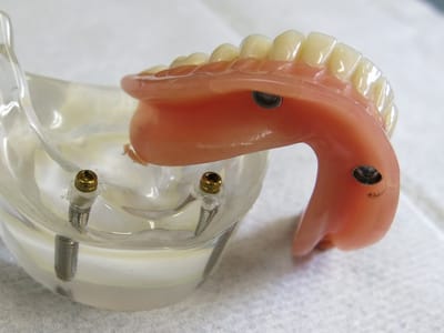 Mesilla Valley Family Dentistry