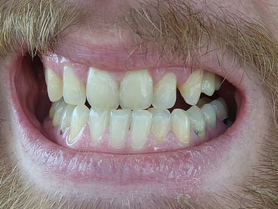 Metro Refresh Dentistry