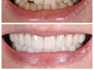 Minot Dental Partners