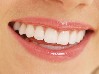 Mitchell Smile Design