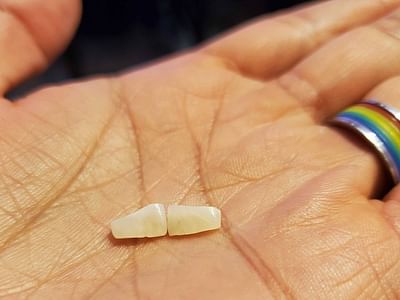 Mohinder Garg, DDS - Dentist in South Plainfield NJ