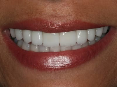 Molldrem Family Dentistry