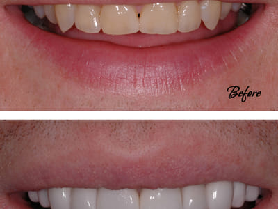 Mont Blanc Center For Dentistry