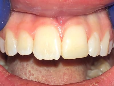 Moran Prairie Dentistry