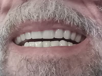 Mountain Empire Dental