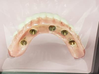 Mt. Ogden Dental and Implant Clinic