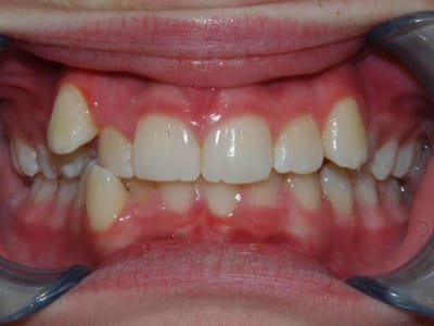 Mt. Ogden Dental and Implant Clinic