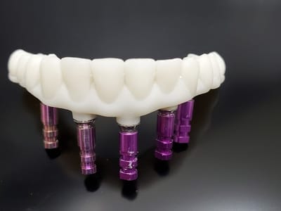 Mt. Ogden Dental and Implant Clinic