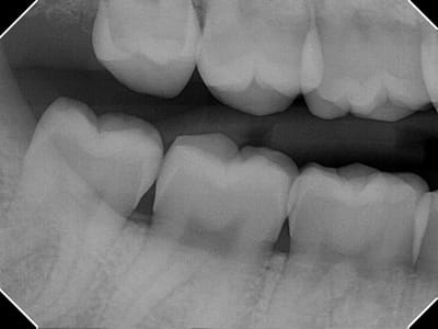 My Dentist PC: The Family Practice