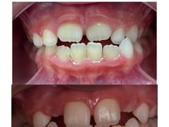 My Tamarac Dentist - Dentist In Tamarac