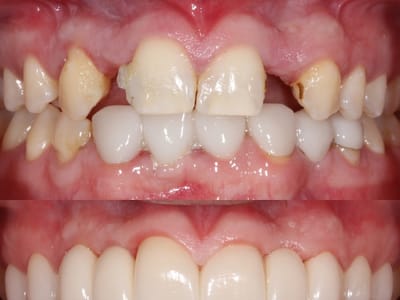 Nashville Restorative Dentistry