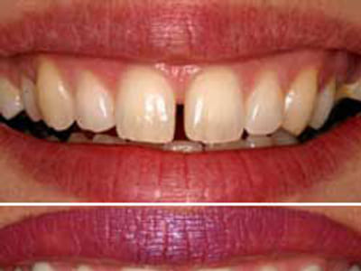 Natural Dentist Associates