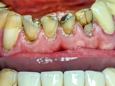 Nebraska Family Dentistry: Northeast Location