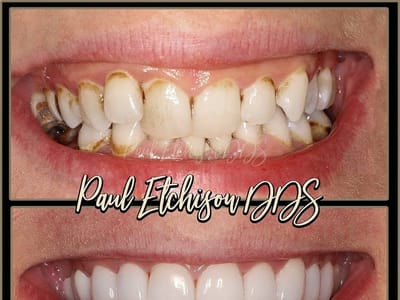 Nelson Ridge Family Dental - Dentist New Lenox