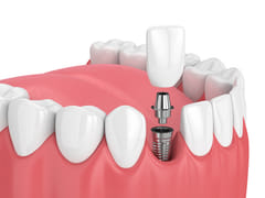Nevada Dentistry & Braces