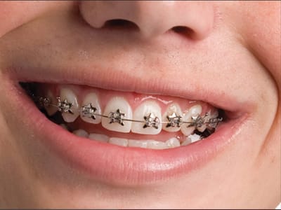 Nevada Dentistry & Braces