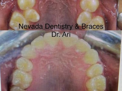 Nevada Dentistry & Braces