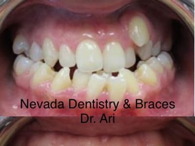 Nevada Dentistry & Braces