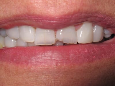 new32 Aesthetic and Family Dentistry