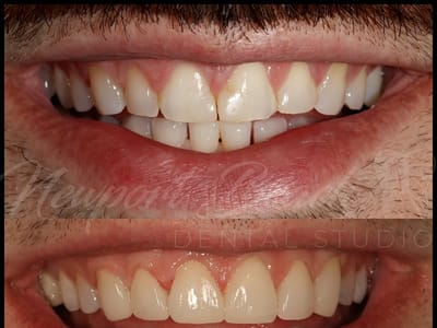 Newport Beach Dental Studio | Dr. Tai Ha, DDS