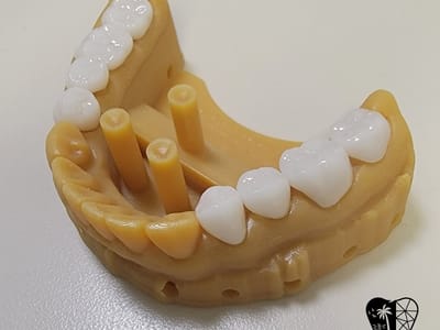 Newport Beach Dental Studio | Dr. Tai Ha, DDS