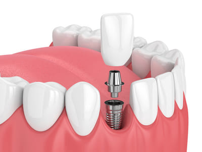 Nicholas G Dose, DMD - Family Dentistry in Lake Oswego