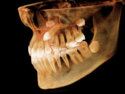 North Atlanta Family Dentistry