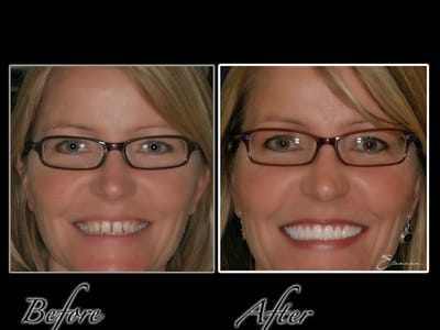 North Valley Family Dentistry - Anthem