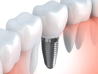 Northland Family Dentistry