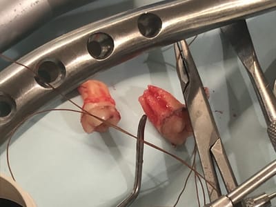 Now Dentistry: Dentist in Baltimore