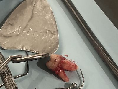 Now Dentistry: Dentist in Baltimore