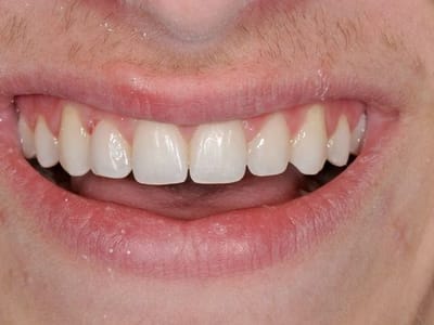 Oak Harbor Family Dentistry