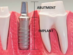 Off Island Dental Care - Cosmetic and Implant Dentistry Bluffton