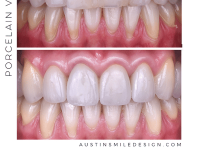 Old Settlers Dental - Round Rock Dentist