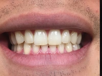 Oquirrh Mountain Dental