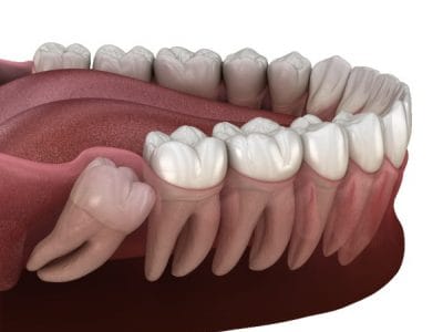 Oral Health Center / Dental care Westerville